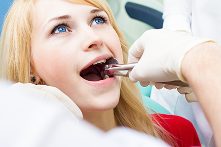 A young woman receiving dental care with her mouth open while seated in a dentist s chair.